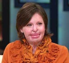 Stephanie Nielson quotes