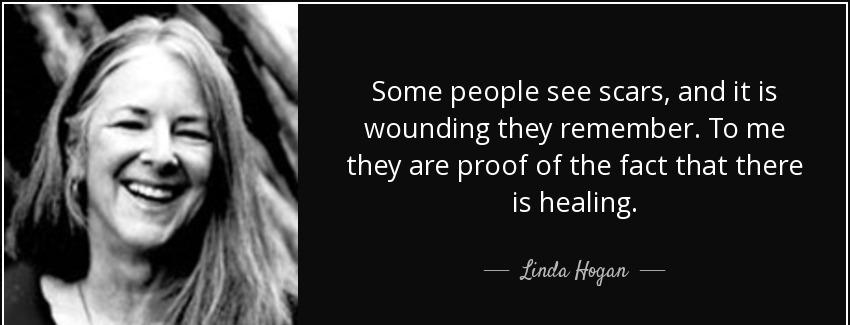 quote some people see scars and it is wounding they remember to me they are proof of the fact linda hogan Quotes
